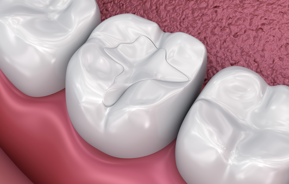 Dental Treatments 47