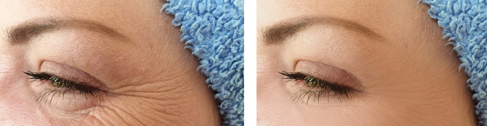 Facial Aesthetics 10 Facial Aesthetics 10
