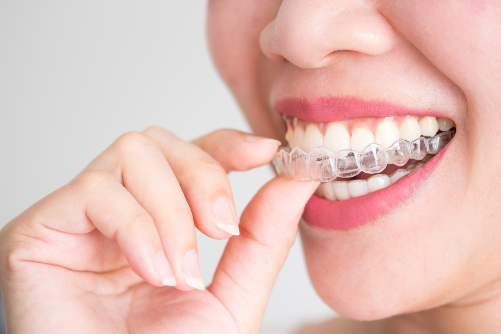 Orthodontics 15 Orthodontics 15